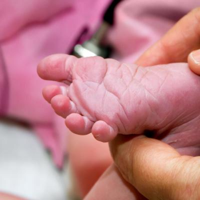 Scorul APGAR: ce reprezintă prima notă a copilului