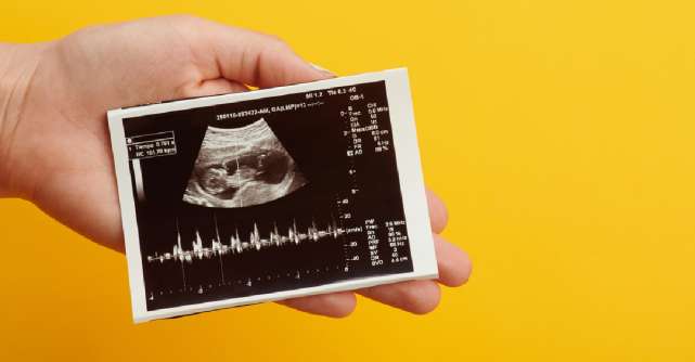 Biometria fetală sau ce reprezintă măsurătorile din ecografia de sarcină din fiecare lună