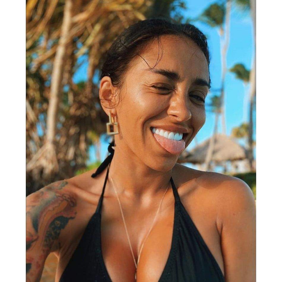 Ruby, plină din cap până în picioare de vânătăi! Cine a putut să îi facă așa ceva artistei?!