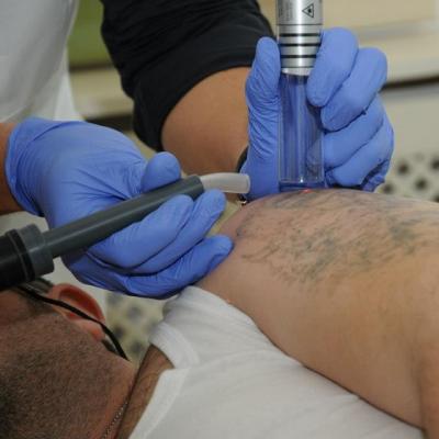 Revlite, laserul preferat de vedete 