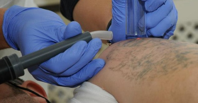 Revlite, laserul preferat de vedete 