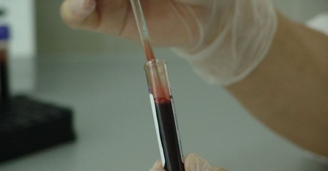 Atentie: 5 Tipuri de cancer fara simptome