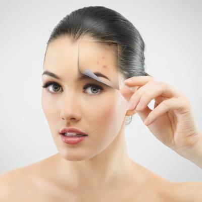 4 Alimente nocive pentru tenul tau