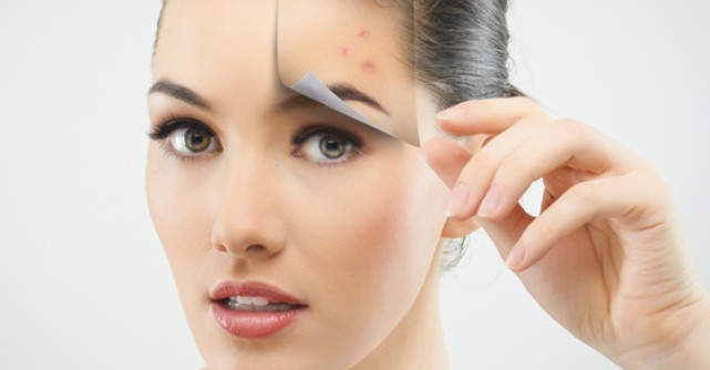 4 Alimente nocive pentru tenul tau