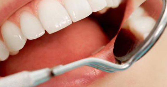 AJUTOR: Ce inseamna sa iti sangereze gingiile