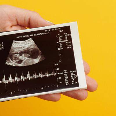 Biometria fetală sau ce reprezintă măsurătorile din ecografia de sarcină din fiecare lună