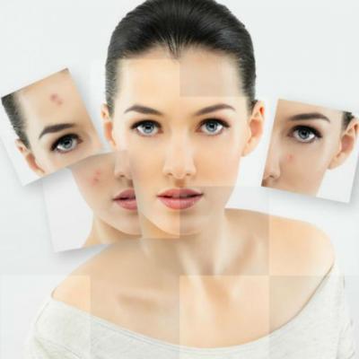 Acnee - Cum decurge o vizita la medicul dermatolog?