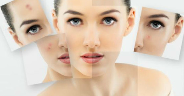 Acnee - Cum decurge o vizita la medicul dermatolog?