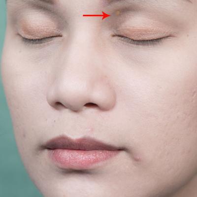 UIMITOR: Ce semne de pe CHIP iti arata ca suferi de INIMA