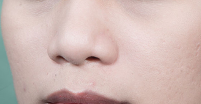 UIMITOR: Ce semne de pe CHIP iti arata ca suferi de INIMA