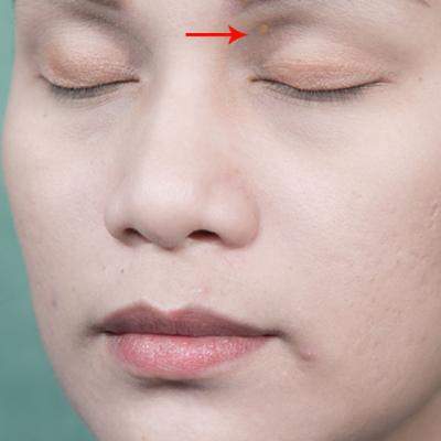 UIMITOR: Ce semne de pe CHIP iti arata ca suferi de INIMA