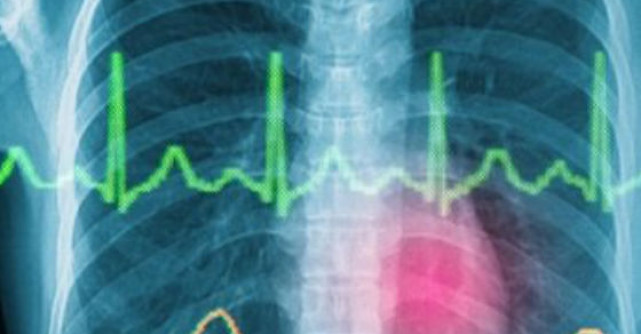 MEDICAMENTUL INIMII: Cel mai simplu si natural mod pentru a preveni bolile de inima!