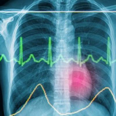 MEDICAMENTUL INIMII: Cel mai simplu si natural mod pentru a preveni bolile de inima!