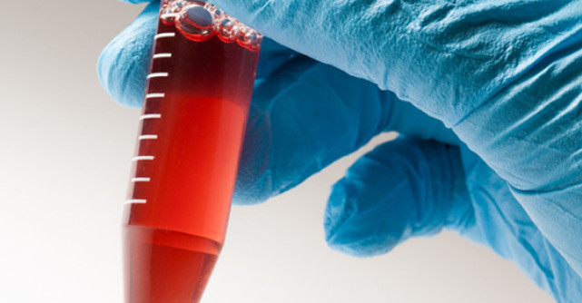 Inventia de Nobel a romanilor: A fost creat SANGELE ARTIFICIAL