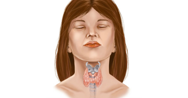 7 Analize pentru TIROIDITA autoimuna Hashimoto