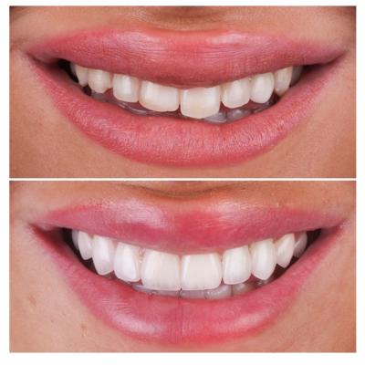  Noul curent de personalizare a zâmbetului pentru pacienții din România