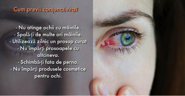 Conjunctivita: care sunt cele mai frecventa cauze si cum sa te feresti
