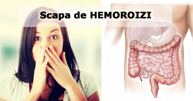 Nimeni nu ti le spune: 5 greseli care provoaca HEMOROIZII