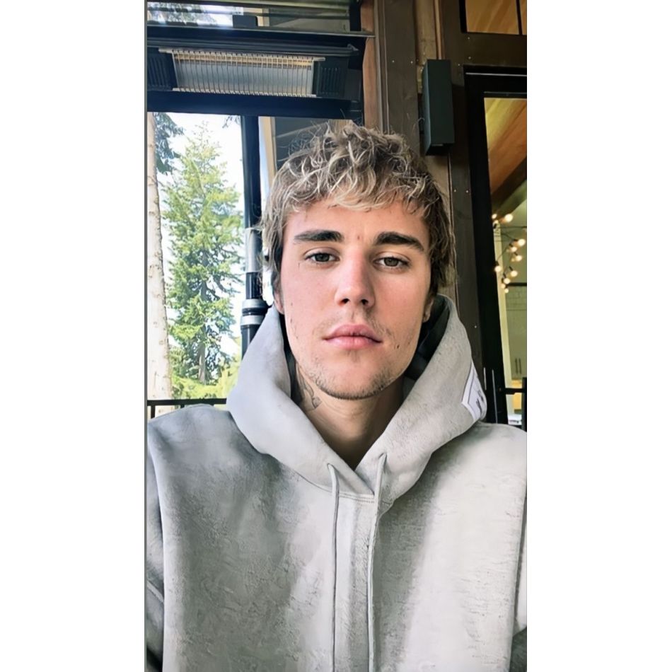 Justin Bieber, noi detalii despre starea sa de sănătate. Artistul a rămas paralizat pe partea dreaptă a feței