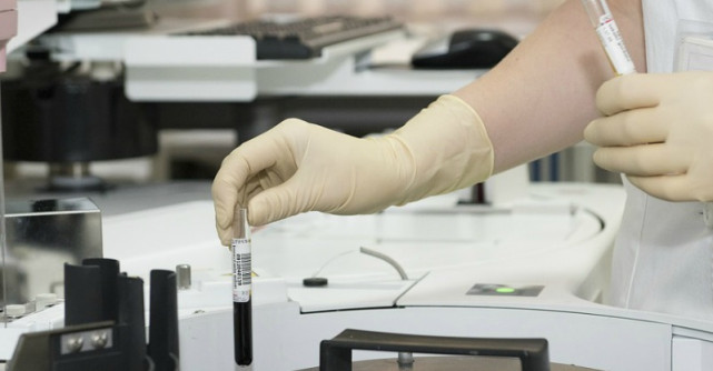 3 analize de rutina pe care este esential sa le faci cel putin o data pe an