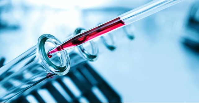 Ce sunt trigliceridele si de ce sunt periculoase? Cauze, diagnostic si tratament