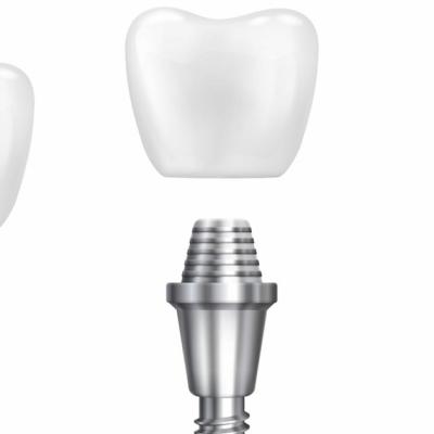 Implant dentar Straumann: de ce este considerat o soluție premium pentru dinții pierduți