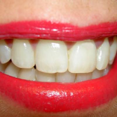 Doar 50% dintre oraseni au o igiena orala adecvata