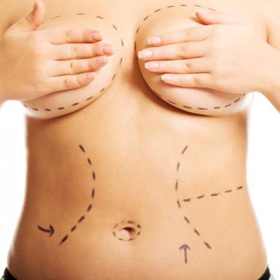 Abdominoplastia, solutia pentru un abdomen plat dupa nastere