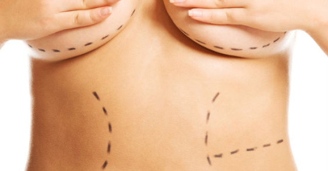 Abdominoplastia, solutia pentru un abdomen plat dupa nastere