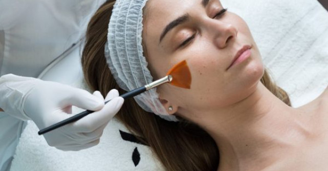 Avra Aesthetic BioRePeelCl3