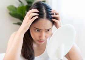 Te mănâncă pielea capului, dar nu ai mătreață? Ce remedii blânde merită încercate înainte să schimbi toate produsele