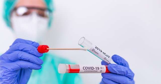 Tot ce trebuie să știi despre testele pentru COVID-19: care sunt acestea, când și cum se pot efectua