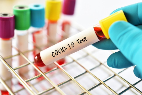 Cum te poti proteja cel mai sigur de coronavirus?