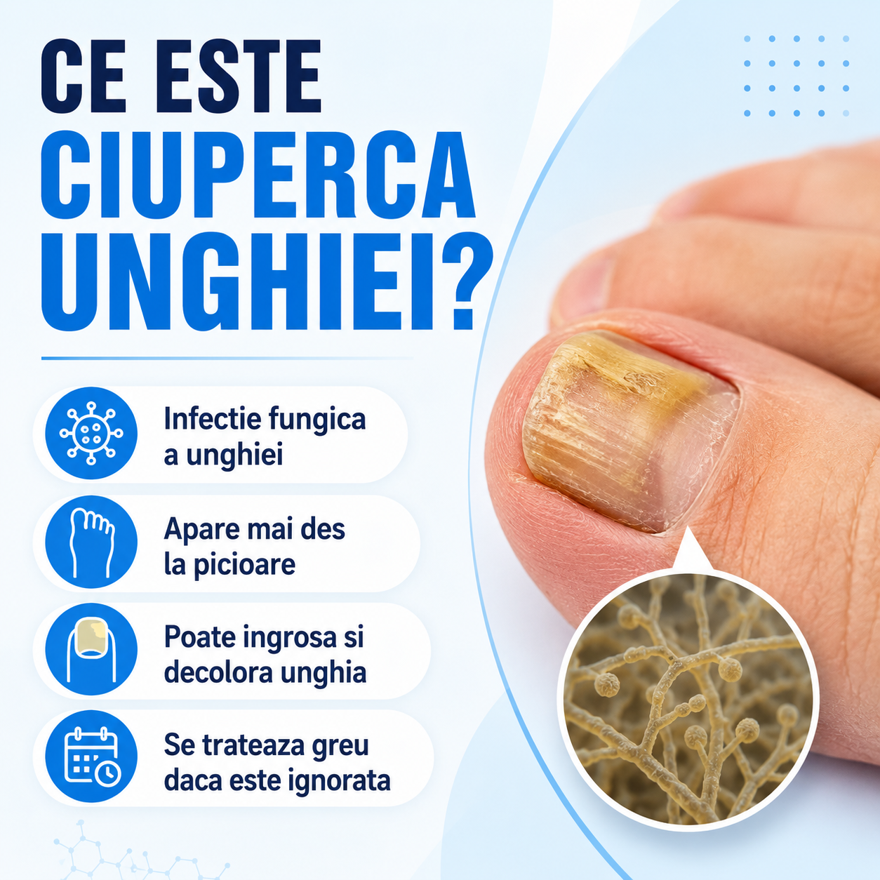 ciuperca unghiei sau onicomicoza: cauze, simptome, tratament, preventie