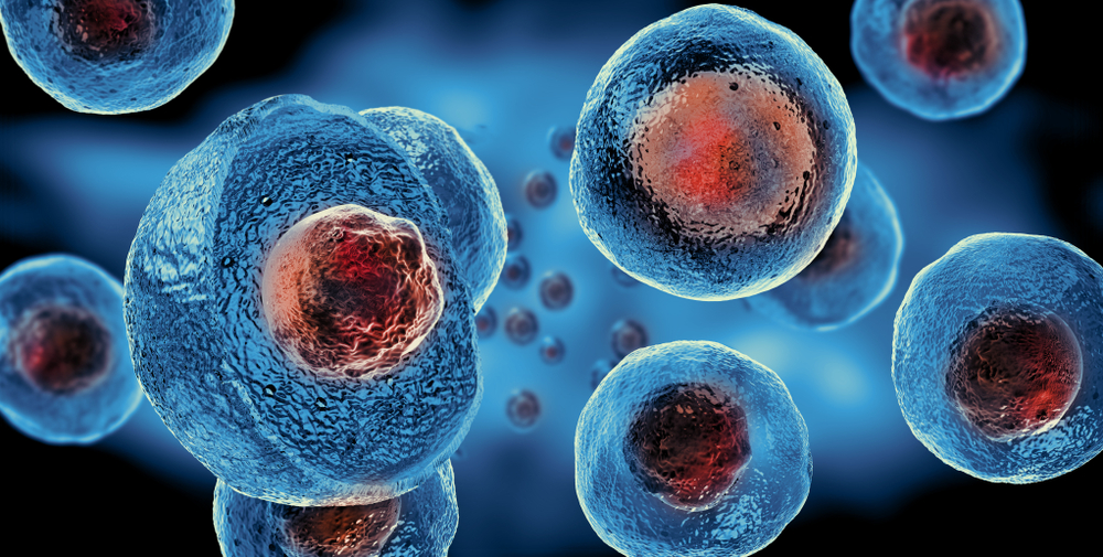 L’efficacité des cellules souches dans la lutte contre la maladie lupique