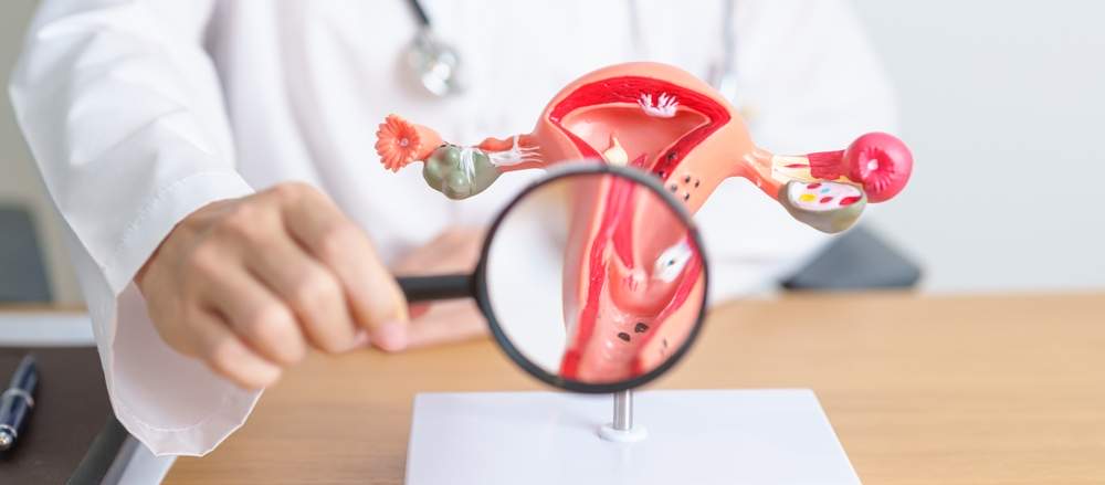 Cum se diagnostichează endometrioza: 7 investigații și teste recomandate